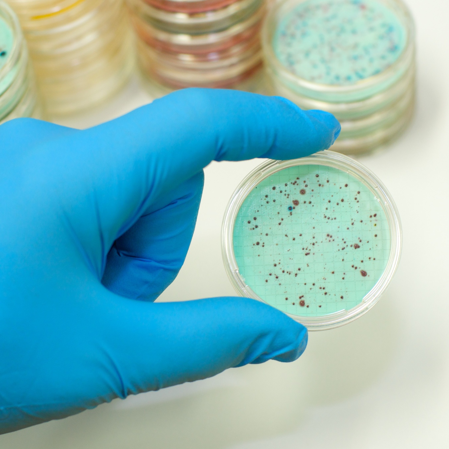 Image of a hand holding a bacteria plate