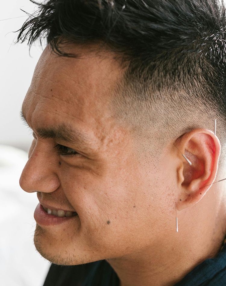 A Man with Needles on His Ear