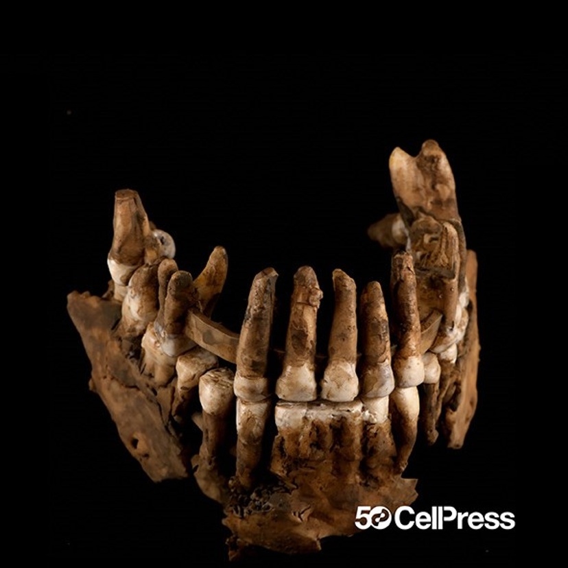 jaw bones