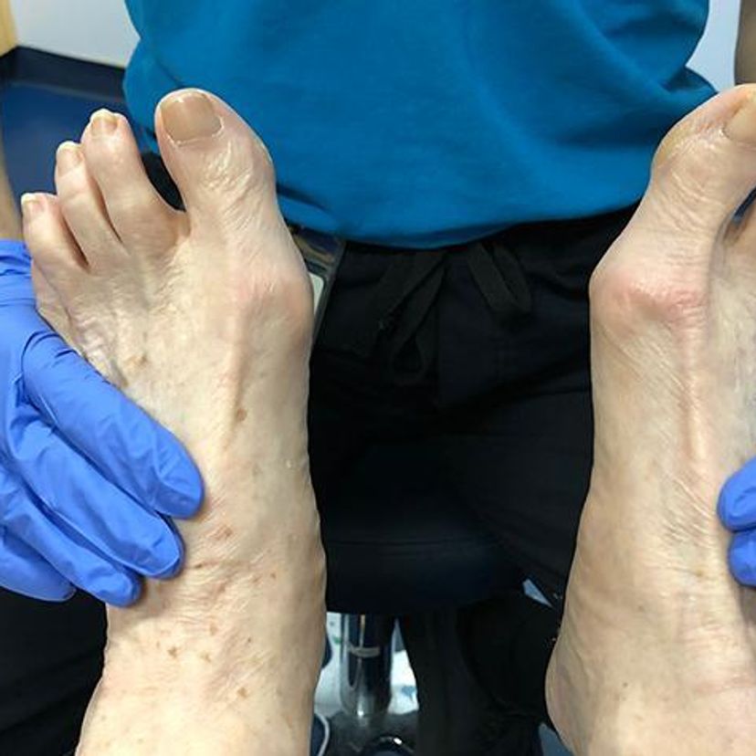Podiatry clinic for flood affected