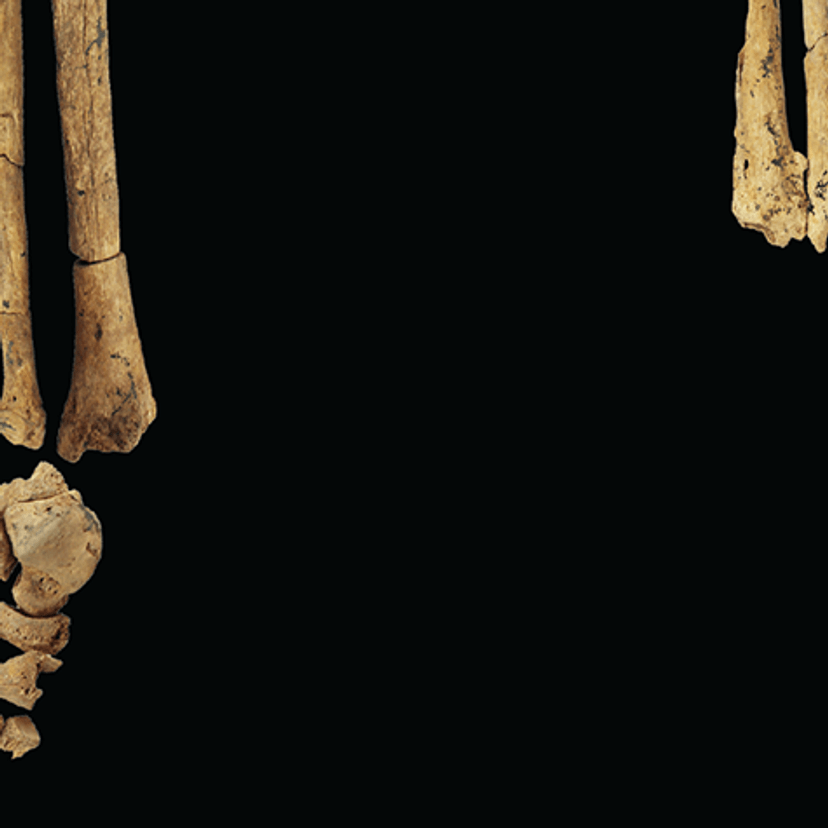 Fossil leg bones with a missing left foot