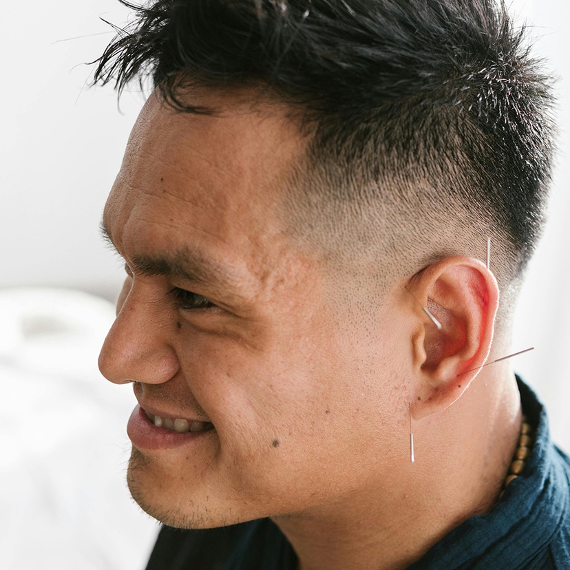 A Man with Needles on His Ear