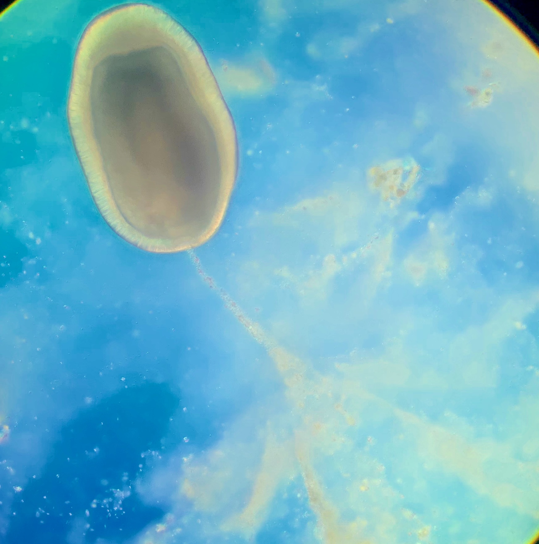 Coral larvae captures food particles with mucous net credit Colleen Rodd