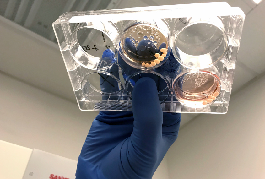 organoids in the lab